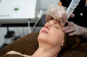 Microdermabrasion Cannock Staffordshire