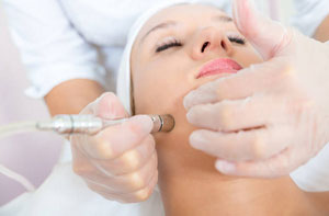 Microdermabrasion Washington Tyne and Wear