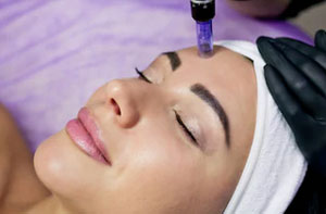 Microneedling Rainworth (NG21) Microneedling Rainworth (NG21)