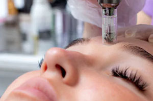 Microneedling Colwyn Bay (LL29) Microneedling Colwyn Bay (LL29)