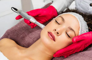 Microneedling Holbeach (PE12)